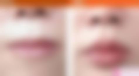 六、童颜博仕医疗美容(武侯区)价格表