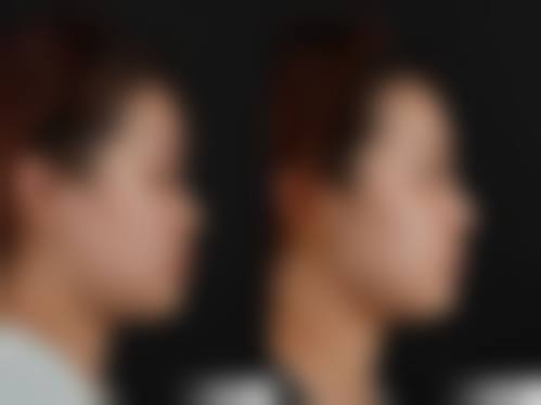 三、金在洪技术优势