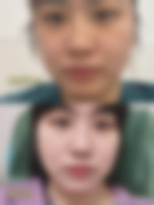 四、童颜博仕医疗美容(武侯区)特色项目