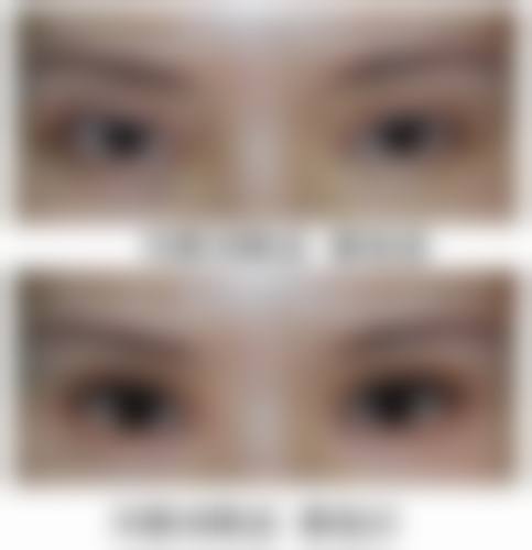 八、珠海科美医疗美容整形门诊部真实的患者评价