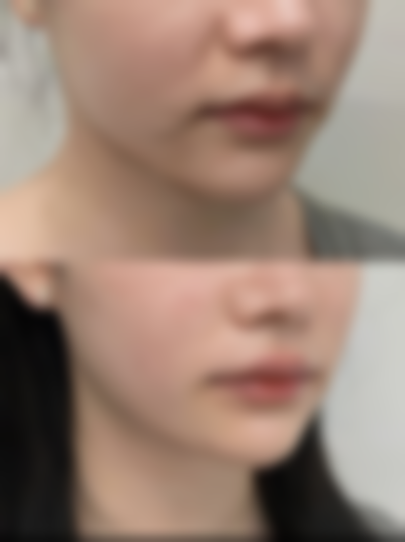 四、珠海科美医疗美容整形门诊部特色项目