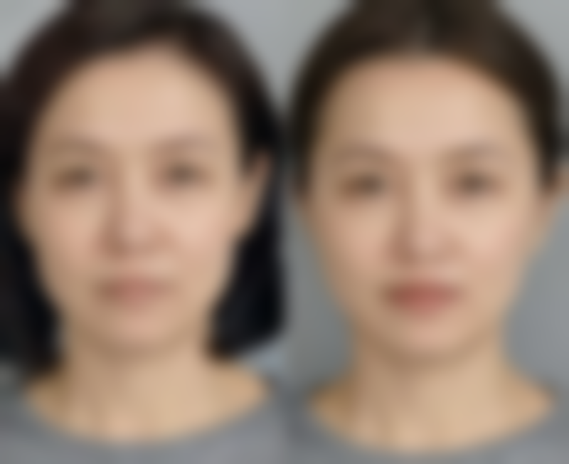 三、治疗方案与注意事项