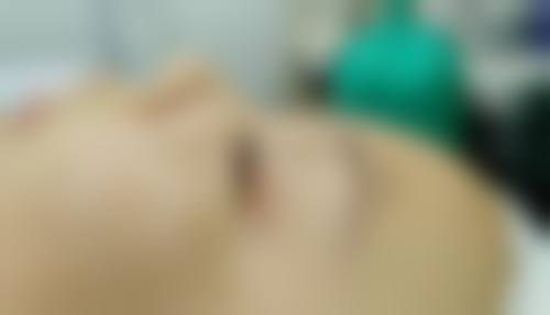 五、植发后可能出现的异常情况及处理方法