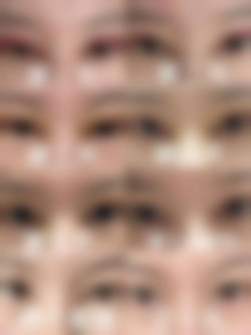 四、昆明鼎立医院医疗美容科特色项目