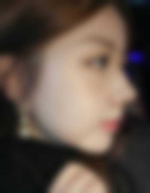 四、韩国韩美人皮肤科医院特色项目