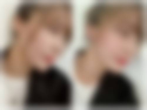 三、昆明鼎立医院医疗美容科诊疗项目有哪些？