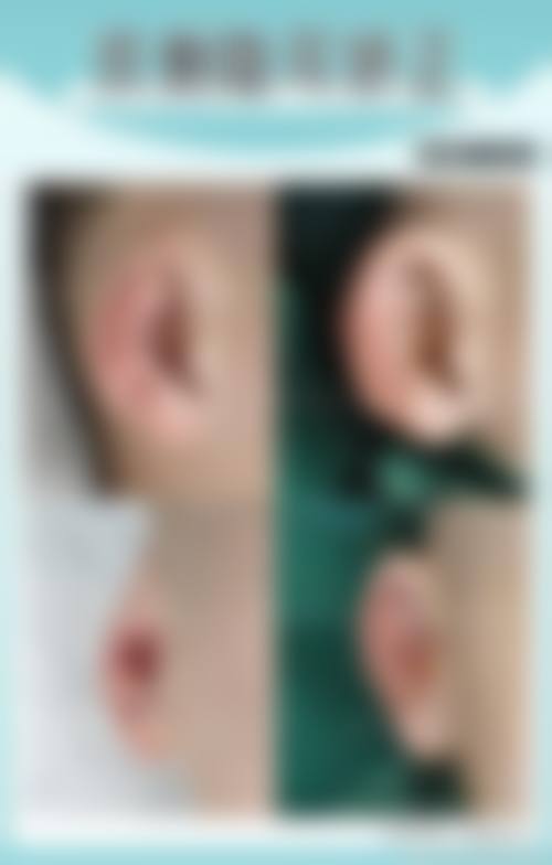 八、韩国韩美人皮肤科医院预约方式