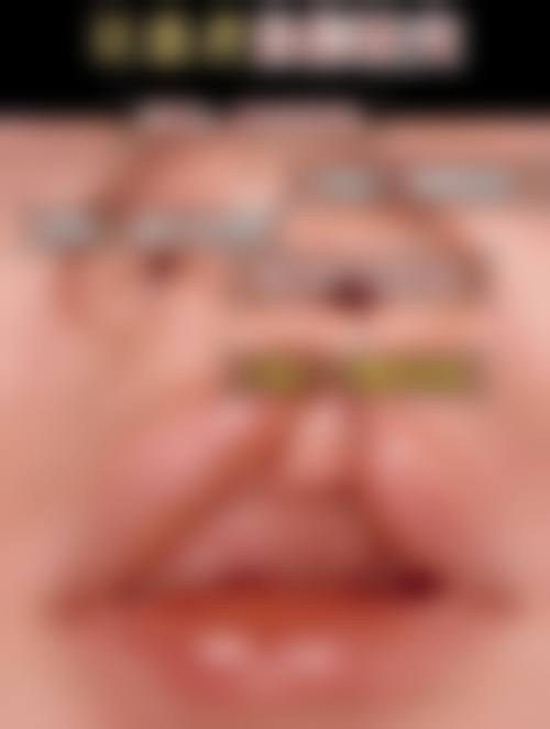 二、韩国韩美人皮肤科医院怎么样？