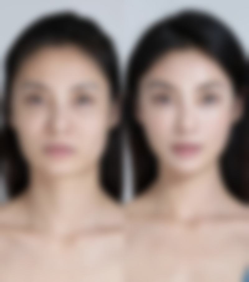 {烫伤曾生疤痕可以恢复吗？科学治疗与护理助您见证疤痕显著改善奇迹 