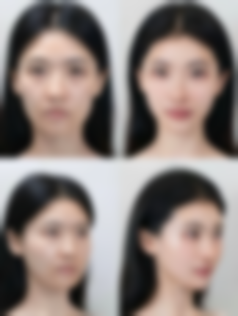 六、治疗烫伤曾生疤痕的注意事项