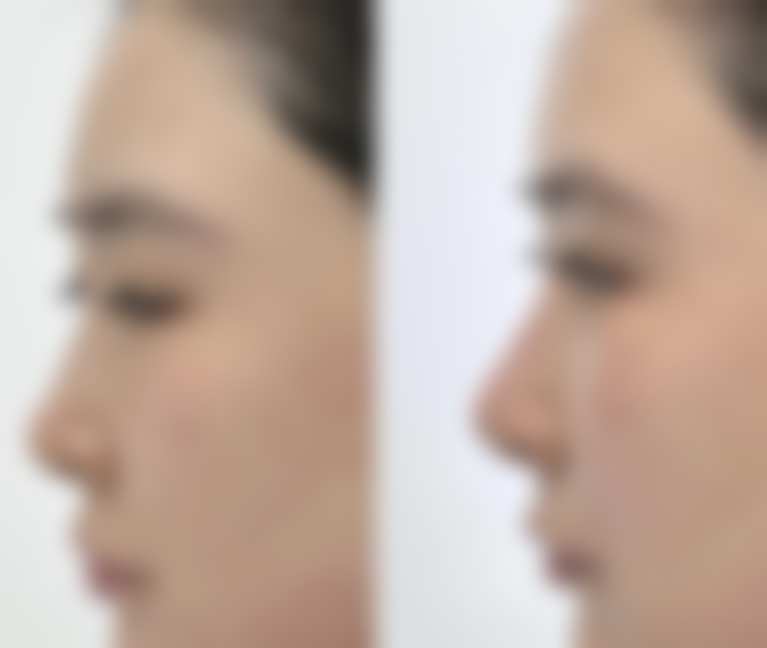 三、闫莉技术优势