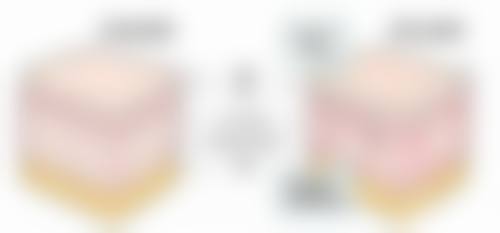 五、术后注意事项