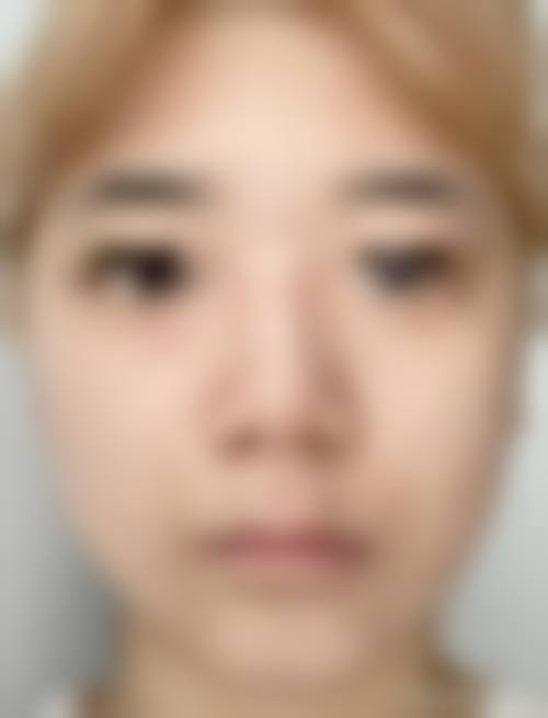 七、南宁瑞心莱思整形医院预约方式