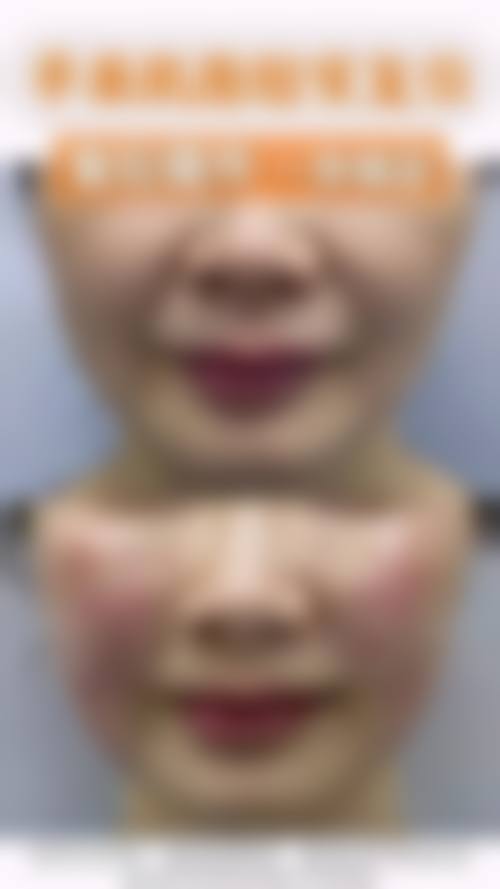 三、南宁瑞心莱思整形医院诊疗项目有哪些？