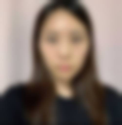 八、南宁瑞心莱思整形医院真实的患者评价