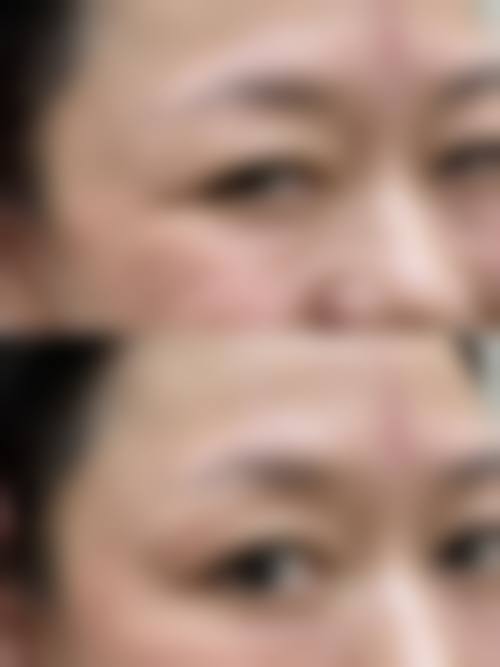 五、天津熙朵丽尊植发整形医院价格表