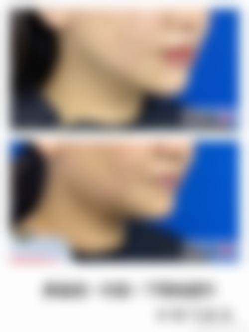 南京五洲医院（私密整形医学中 心）怎么样？