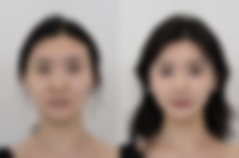 五、特殊护理方法