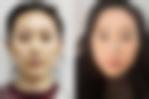 四、郑州星艾雅医疗美容门诊部特色项目