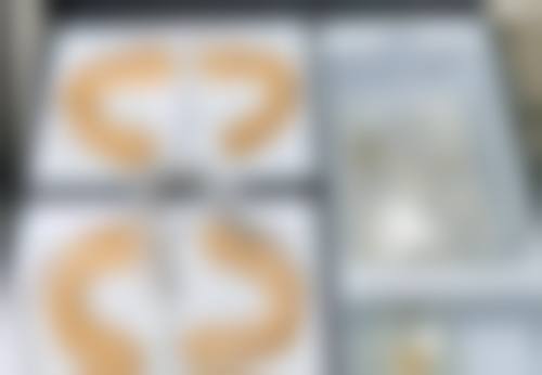 三、北京新生植发医院诊疗项目有哪些？