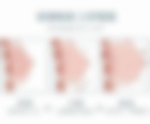 五、内吸眼袋后需要警惕的异常情况