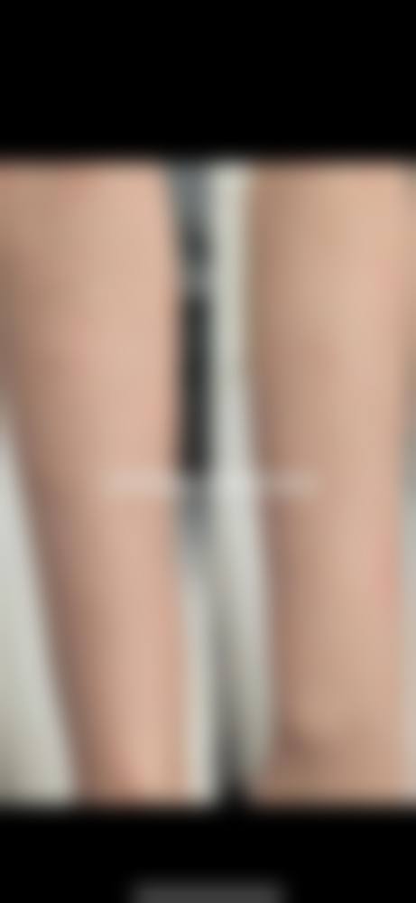 三、杨承革技术优势