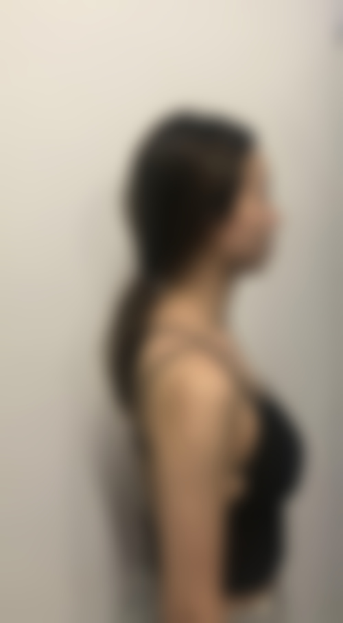 八、郑州星艾雅医疗美容门诊部真实的患者评价