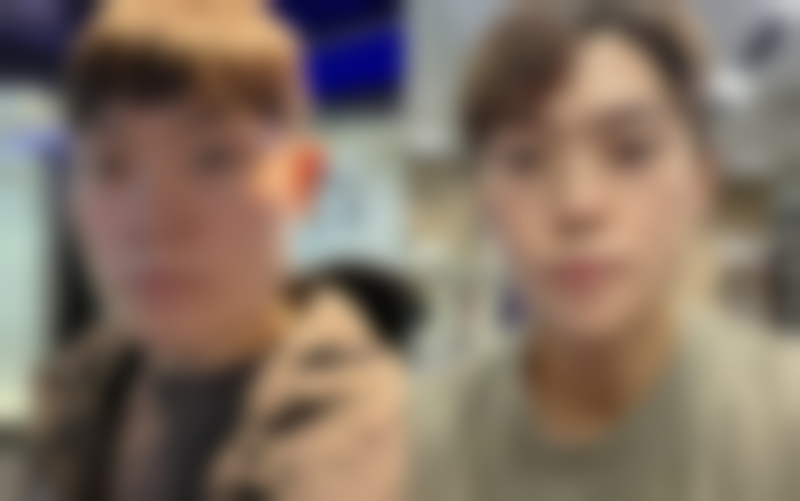 {打面部除皱针面部僵硬怎么办？教你多招有效缓解恢复自然表情