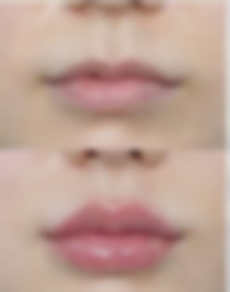 一、了解面部僵硬的原因