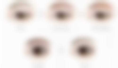 二、假体丰太阳穴的修复阶段