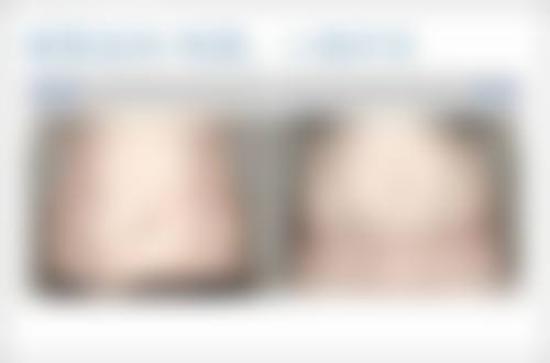 二、日常小妙招，轻松缓解眼袋问题