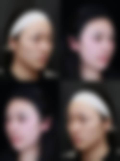 八、许昌博爱医疗整形医院真实的患者评价