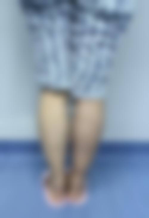 五、新疆乌鲁木齐华美整形医院价格表