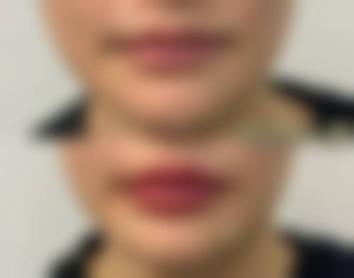 五、许昌博爱医疗整形医院价格表