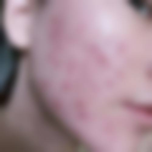 三、新疆乌鲁木齐华美整形医院诊疗项目有哪些？