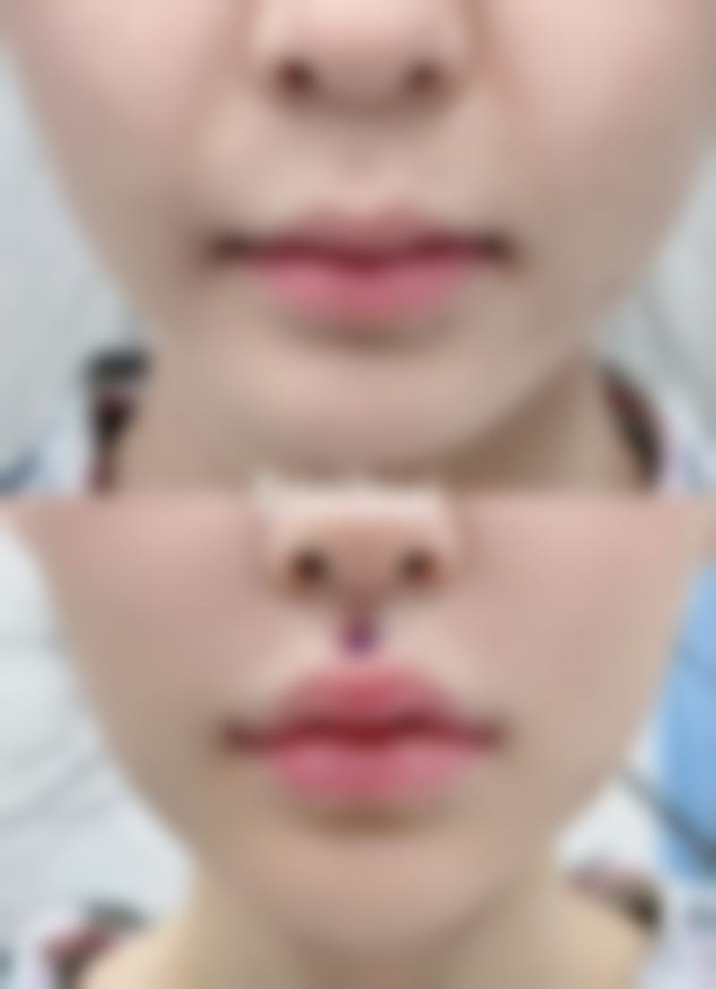 二、日常护理与预防