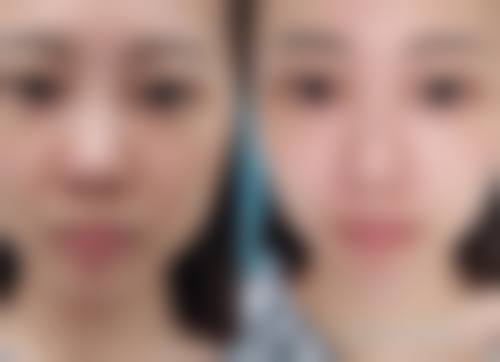 四、武汉四良轻医美整形医院特色项目