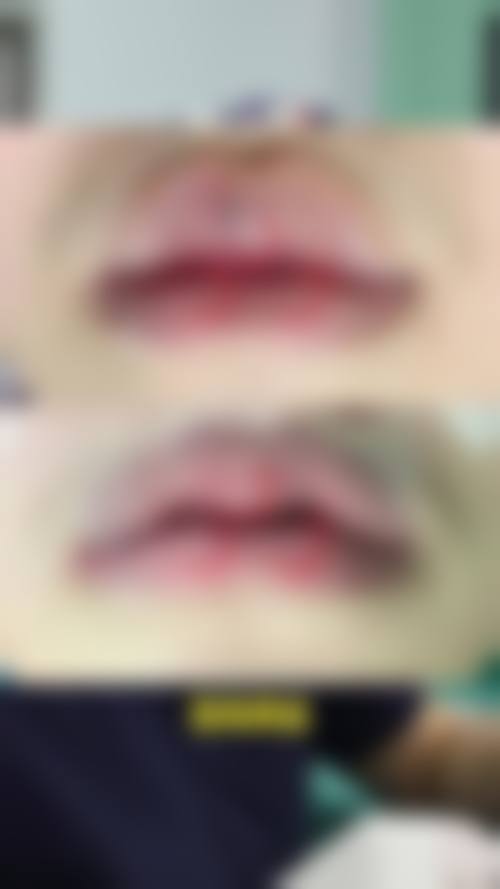 九、重庆造美坊整形美容门诊部真实的患者评价