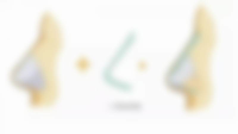 二、卫爱侠擅长项目