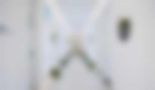 五、真实实例见证5S脂肪艺术体雕的魅力