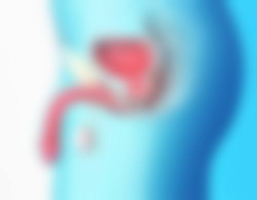 二、疤痕疙瘩的治疗方案