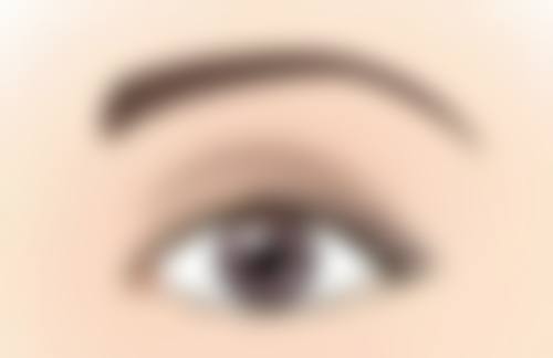 四、怎么去除眼袋：其他辅助方法及注意事项