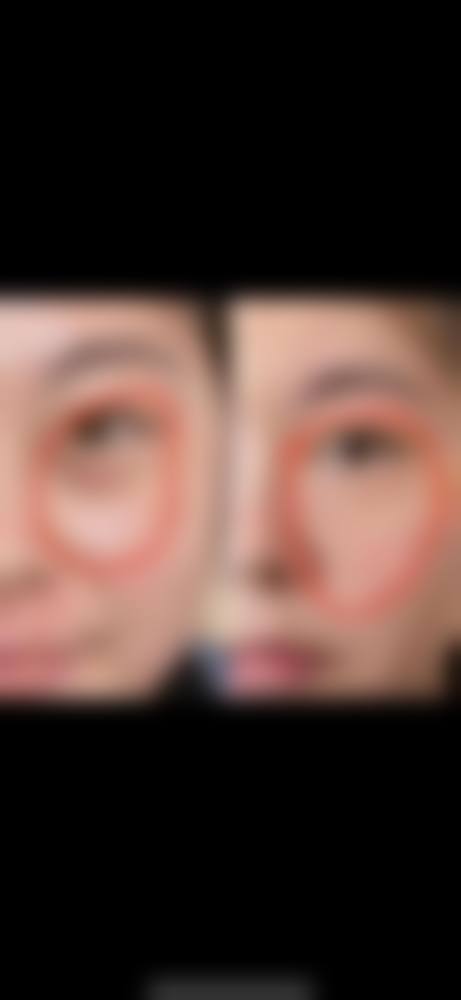 八、日照市北京路医院纯韩整形中 心真实的患者评价