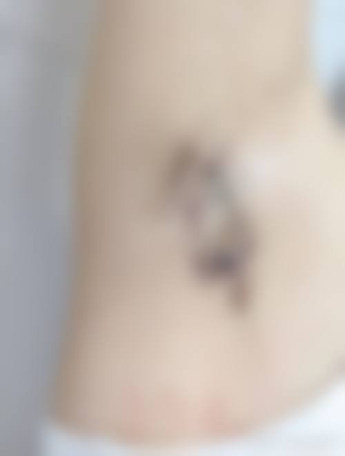 五、蚌埠美愿整形医疗价格表