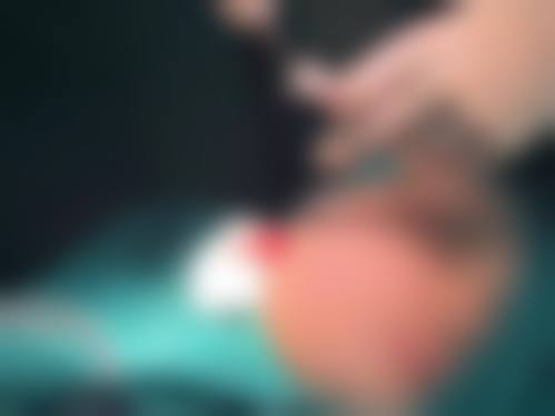 八、广州韩佳人医疗美容门诊部真实的患者评价