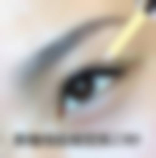 九、广州名韩医疗美容医院真实的患者评价