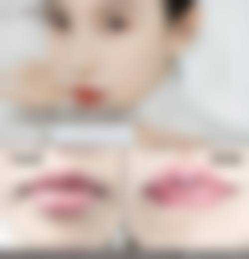 四、广州名韩医疗美容医院特色项目