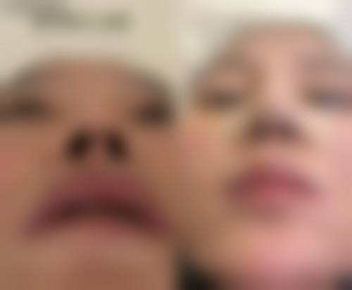 五、日照市北京路医院纯韩整形中 心价格表