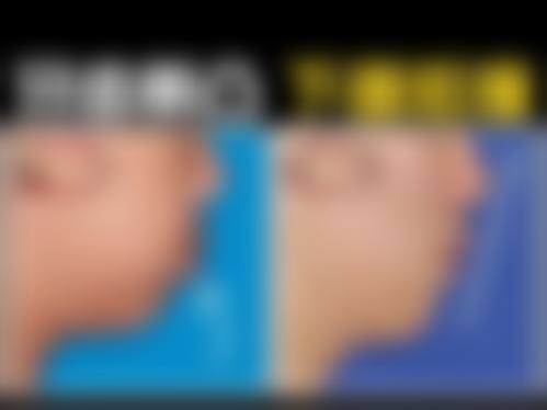 三、杭州兔曦兰积整形医院诊疗项目有哪些？