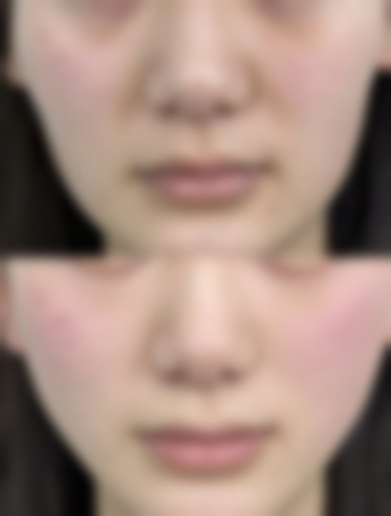 三、怎么去除眼袋：日常护理小妙招